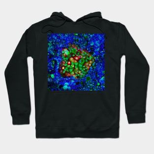 Colorectal cancer cells, light micrograph (C021/6371) Hoodie